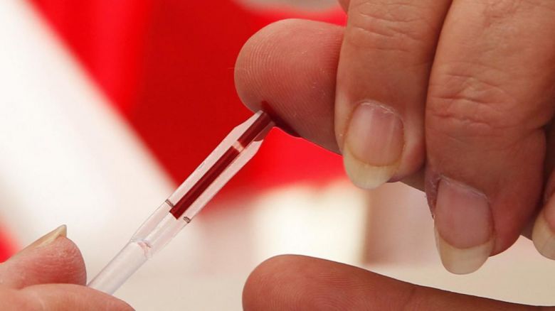 Más de 140 mil personas viven con VIH Sida en la Argentina y no descendió la mortalidad