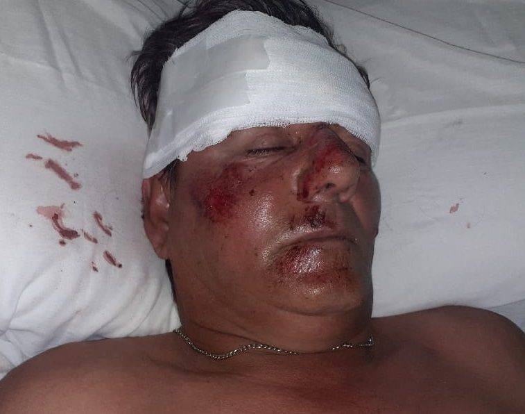 Justiniano Posse: perros en la calle provocaron heridas a dos personas