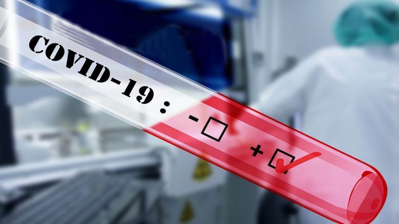 Coronavirus: reportaron  78 muertes y 40.982 contagios