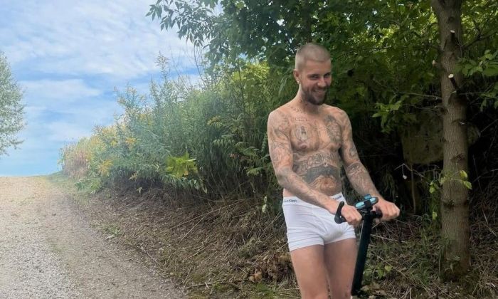 Justin Bieber reveló que sufrió una dolorosa lesión tras caer de un monopatín eléctrico